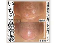 リアン(Riant)/毛穴ケアコース 