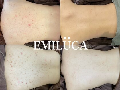 エミルカ 北谷店(EMILUCA)の写真