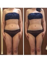 プリンセス バイ セイフティプリンセス 長野店(PRINCESS)/ブライダルエステ