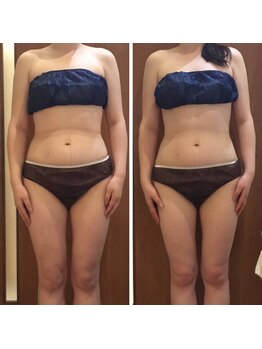 プリンセス バイ セイフティプリンセス 長野店(PRINCESS)/ブライダルエステ