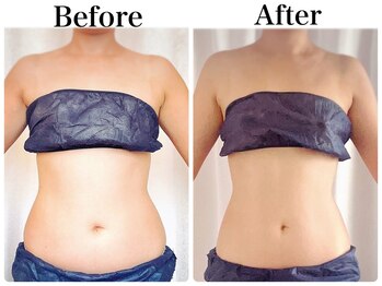 トレゾール(tresor)