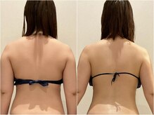 クラヴェル(Clavel)/最新マシンで綺麗なラインに