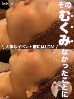 ジェノール 2nd beauty studio 姫路駅前店(JNOEL)/〈むくみ〉なかったことに！？