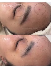 ユンプラス(yun+)/【Before/After】