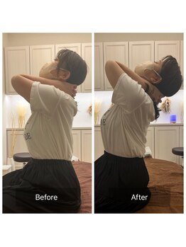 カドル 新宿店(KADORU)/美容整体 Before-After