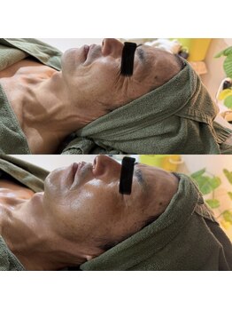 シーアイエステティック 船橋駅前店(c.iエステティック)/メンズフェイシャル★