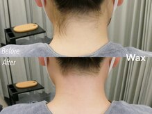 アイロンボーイ(IRONBOY)/うなじ＋首筋WAX ｜脱毛ワックス
