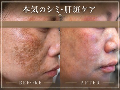 パルティール(PARTIR)の写真