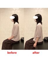 ナオル整体 福岡香椎院(NAORU整体)/30代女性施術事例【首の痛み】