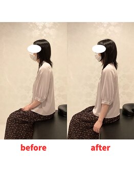 ナオル整体 福岡香椎院(NAORU整体)/30代女性施術事例【首の痛み】