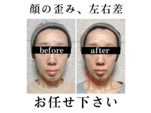 キュープ 名張店(Qpu)の雰囲気（施術後は、小顔だけなく、顔の左右バランスも均等に！）