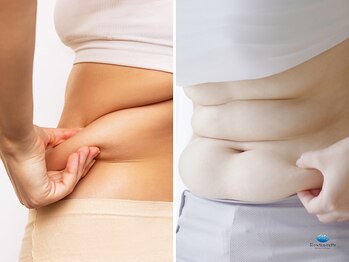 スローティラテ 中道店/痩身マシン組み合わせで本気痩せ