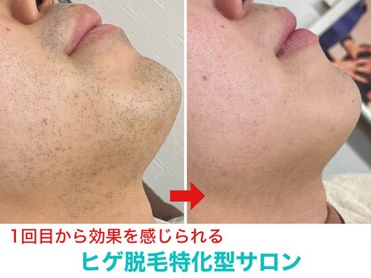 ミスターアンクール 鹿児島(Mr.uncoeur)の写真