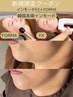 【速攻小顔】シャープな輪郭へ★韓国本場インモード(最新FX+FORMA)¥13000