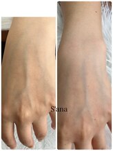 サナ 久が原 千鳥町(S’ana)/ハーブピーリング