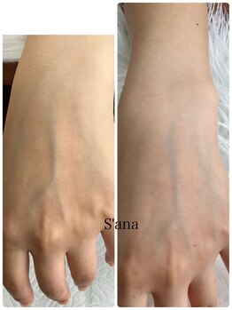 サナ 久が原 千鳥町(S’ana)/ハーブピーリング