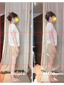 スイレン 西新宿(SUIREN)/姿勢改善