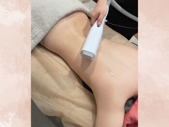 ハナ チュチュ(Hana chuchu)/お顔からつま先まで全身脱毛♪