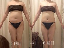 上野エステサロン レア(Lea)/痩身／エステ