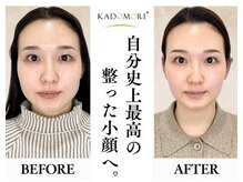 ザ リフト カドモリ 鹿児島 霧島(The Lift KADOMORI)