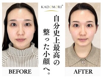 ザ リフト カドモリ 鹿児島 霧島(The Lift KADOMORI)