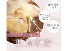 キワミ サーティスリー(kiwami33)の雰囲気(ダブルピーリングがお肌本来のキレイを呼び覚まし肌悩みレスに◎)