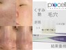 結果重視！本気の肌質改善【プロセルセラピーズ】バイオ成長因子幹細胞導入◆