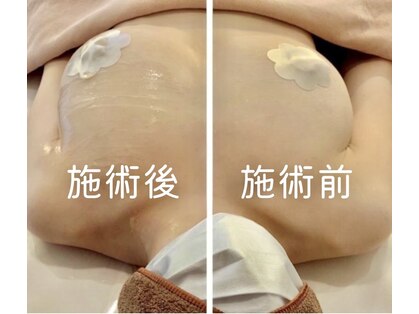 アネラ(ANERA) 心斎橋の写真