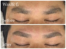フルミー(fulme.)/WAX脱毛before＆after