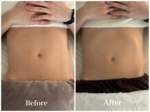 リリー 中目黒(Lily)/60分施術 Before→After