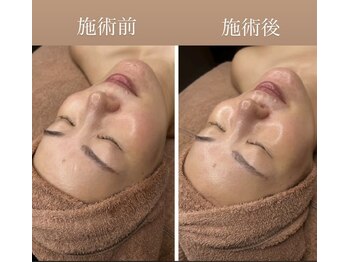 シャルム(CHARME)/ララピール