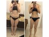 【人気No.1★】ハイパーナイフ全身痩身+脂肪分解リンパマッサージ 90分