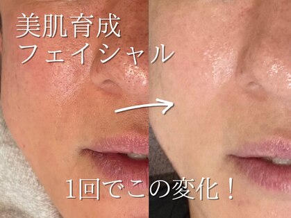 メンズビューティサロン ブレス(bless)の写真