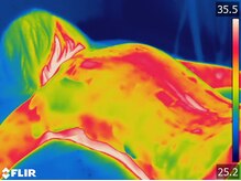 美人バスト アンド ヒップアップ 広島店/マシーン施術後の冷え解消