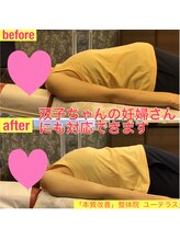 ユーテラス/双子の妊婦さんの調整