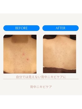 ミーティア(Meteor)/