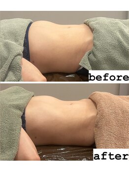 ユヴィラ(YUVIRA)/リンパ×腸もみがオススメ◎