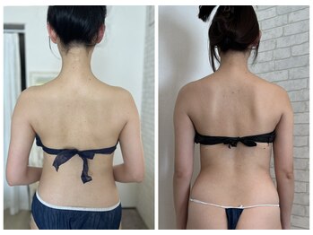 グリーミン 代々木(gleaming)/ブライダルエステ前後比較