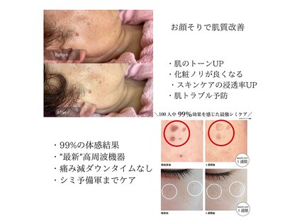 お顔そりルーム ツリー(Tree)の写真
