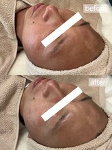 フェリノ(FERINO)/クールビタミントリートメント