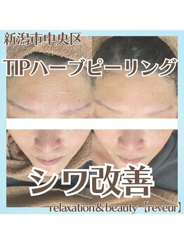 レヴール(reveur)/ハーブピーリングで美肌ケア