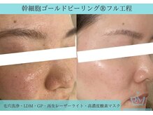 リメイク 広尾(REMAKE)/