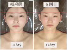 千歳の女神 刈谷店/Before/After