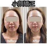 フェイエール鍼灸院 ラスィーヌ(fier鍼灸院 racine)