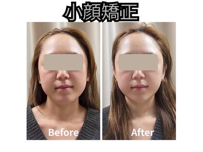 フェイエール鍼灸院 ラスィーヌ(fier鍼灸院 racine)の写真