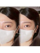 ルナビューティー(Luna beauty)/