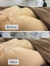 リアン 栄店(Lien)/Before★After/バスト悩み改善◎