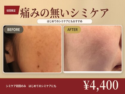 ノーファンデの樹 健康の丘の写真