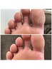 【Footケア】フットケア+足裏の角質除去スペシャルコース♪