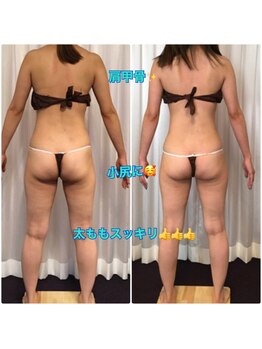 ボディエステティック アクアオーラ 富山店/花嫁さん